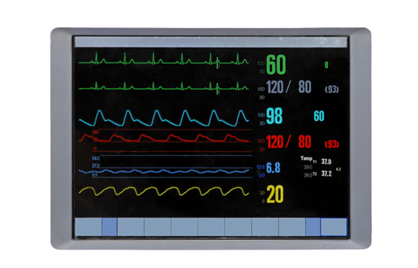 Ecg Device Monitor Example How to Use a Portable ECG Monitor – BeC ECG Monitor
